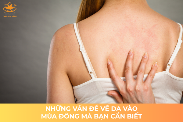 Những Vấn Đề Về Da Vào Mùa Đông Mà Bạn Cần Biết 